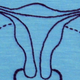 Illustration for article titled Why Some Women Are Born With Ovaries But No Uterus